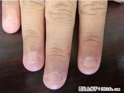剪指甲、挖耳屎,这些日常小动作竟隐藏大危害! - 许昌生活资讯 - 许昌28生活网 xc.28life.com